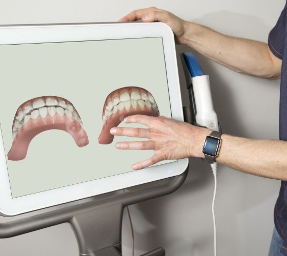 Northampton orthodontist gesturing at digital impressions of teeth on computer monitor