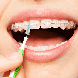 Patient using specialized brush to clean braces