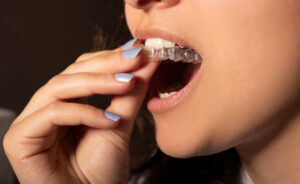 Teenager holding clear aligner