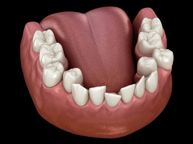 digital image of crooked teeth
