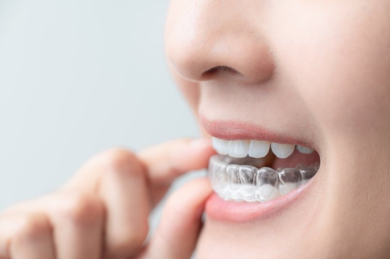 patient wearing Invisalign clear aligner